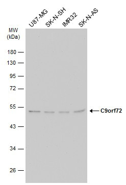 C9orf72 Antibody in Western Blot (WB)