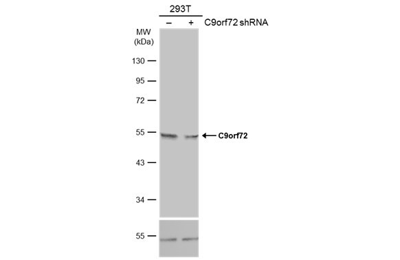 C9orf72 Antibody in Western Blot (WB)