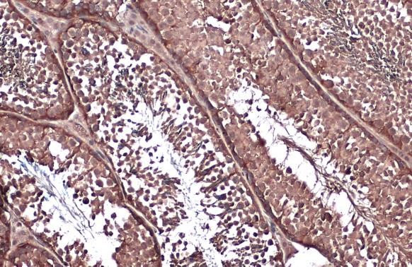 Vinculin Antibody in Immunohistochemistry (Paraffin) (IHC (P))