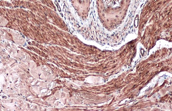 Vinculin Antibody in Immunohistochemistry (Paraffin) (IHC (P))