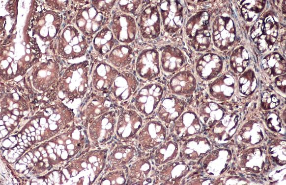 Vinculin Antibody in Immunohistochemistry (Paraffin) (IHC (P))