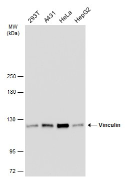 Vinculin Antibody in Western Blot (WB)