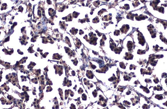 ATM Antibody in Immunohistochemistry (Paraffin) (IHC (P))