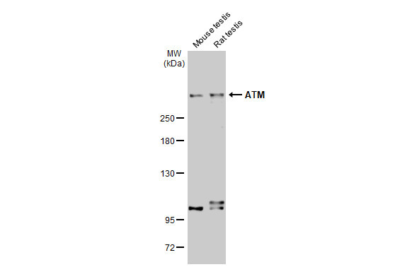 ATM Antibody in Western Blot (WB)