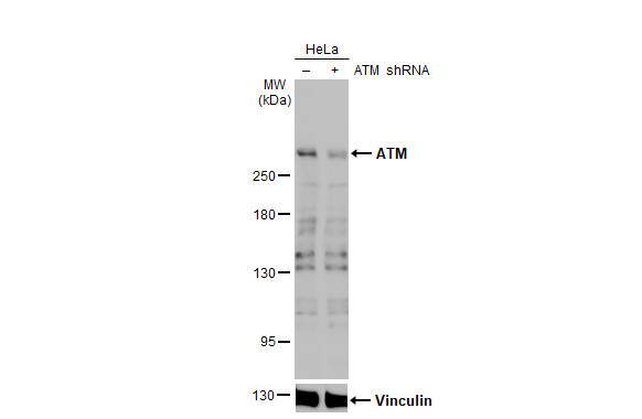 ATM Antibody in Western Blot (WB)