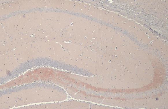 C9orf72 Antibody in Immunohistochemistry (Paraffin) (IHC (P))