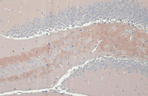 C9orf72 Antibody in Immunohistochemistry (Paraffin) (IHC (P))