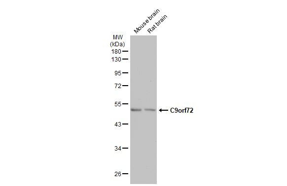 C9orf72 Antibody in Western Blot (WB)