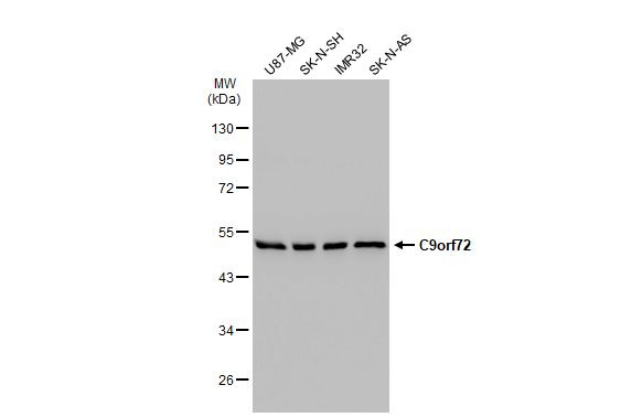 C9orf72 Antibody in Western Blot (WB)