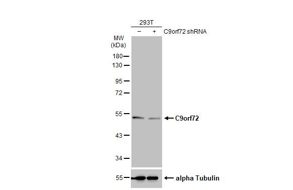 C9orf72 Antibody in Western Blot (WB)