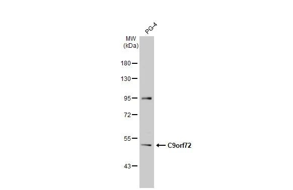 C9orf72 Antibody in Western Blot (WB)