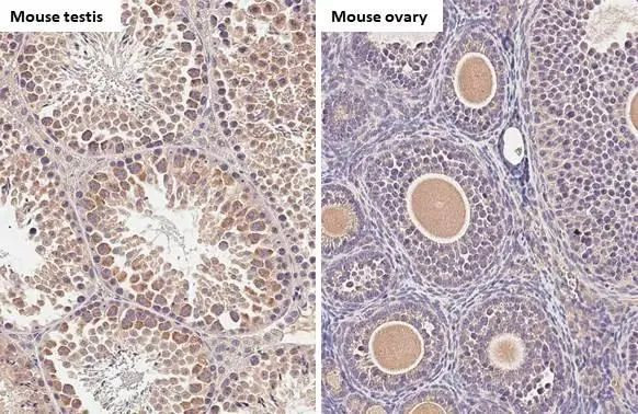 C9orf72 Antibody in Immunohistochemistry (Paraffin) (IHC (P))