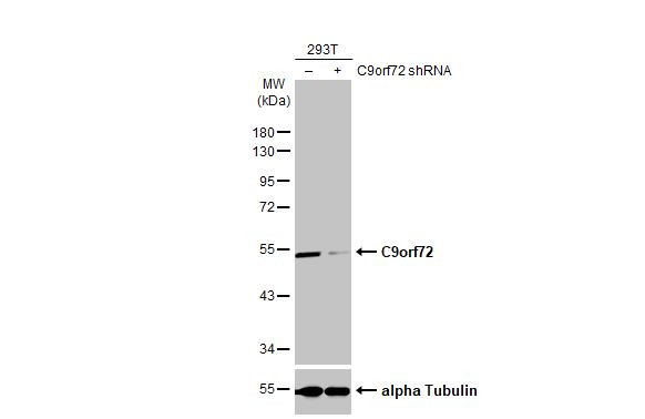 C9orf72 Antibody in Western Blot (WB)