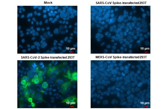 SARS-CoV-2 Spike Protein RBD (strain Wuhan-Hu-1) Antibody in Immunocytochemistry (ICC/IF)