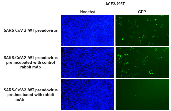 SARS-CoV-2 Spike Protein RBD (strain Wuhan-Hu-1) Antibody in Neutralization (Neu)