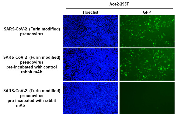 SARS-CoV-2 Spike Protein RBD (strain Wuhan-Hu-1) Antibody in Neutralization (Neu)