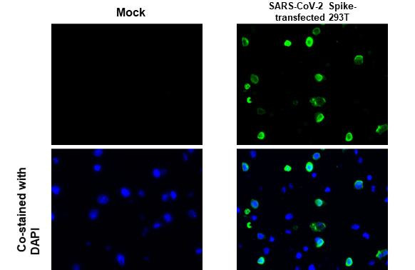 SARS-CoV-2 Spike Protein S2 Antibody in Immunocytochemistry (ICC/IF)