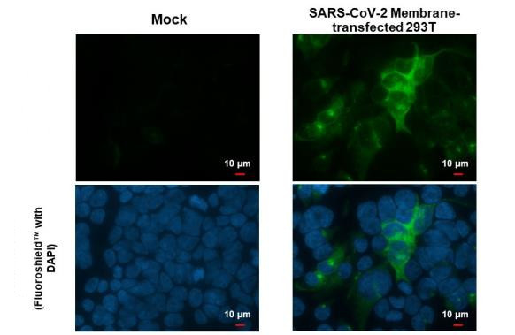 SARS-CoV-2 Membrane Antibody in Immunocytochemistry (ICC/IF)