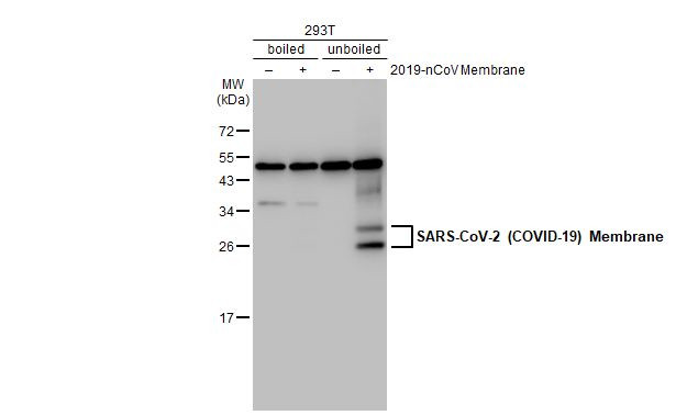 SARS-CoV-2 Membrane Antibody in Western Blot (WB)