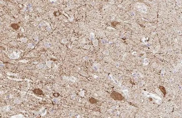 GAD67 Antibody in Immunohistochemistry (Paraffin) (IHC (P))