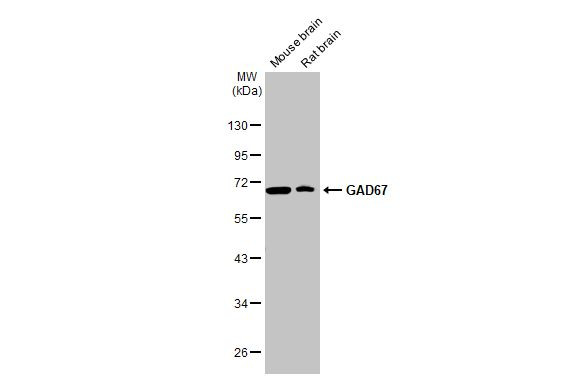 GAD67 Antibody in Western Blot (WB)