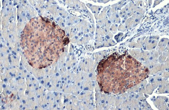 Somatostatin Antibody in Immunohistochemistry (Paraffin) (IHC (P))