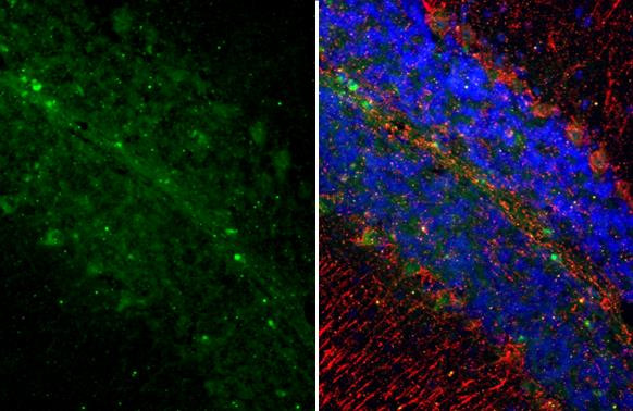 Somatostatin Antibody in Immunohistochemistry (Paraffin) (IHC (P))