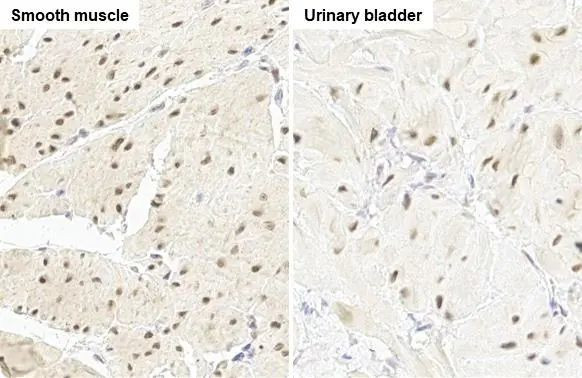 RBPMS Antibody in Immunohistochemistry (Paraffin) (IHC (P))