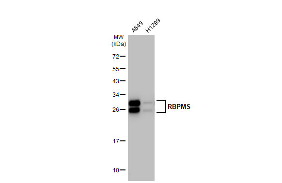 RBPMS Antibody in Western Blot (WB)