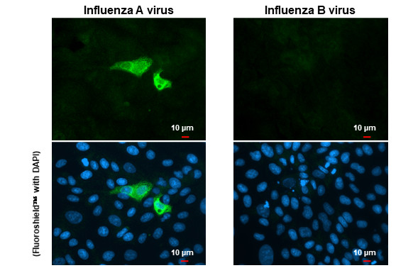 Influenza A H1N1 NA (A/WSN/1933) Antibody in Immunocytochemistry (ICC/IF)