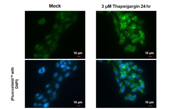 SQSTM1 Antibody in Immunocytochemistry (ICC/IF)