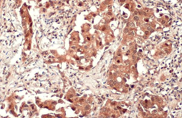 SQSTM1 Antibody in Immunohistochemistry (Paraffin) (IHC (P))