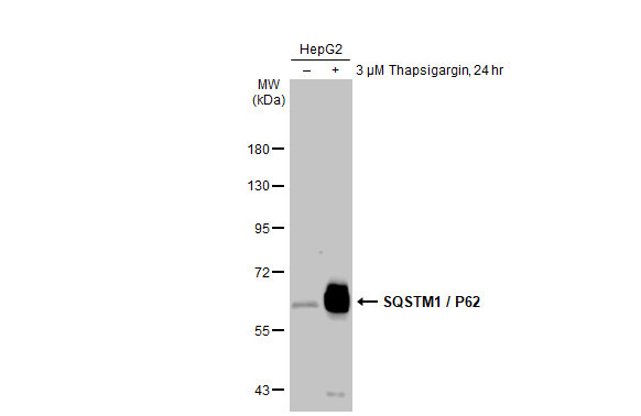 SQSTM1 Antibody in Western Blot (WB)