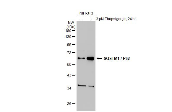 SQSTM1 Antibody in Western Blot (WB)