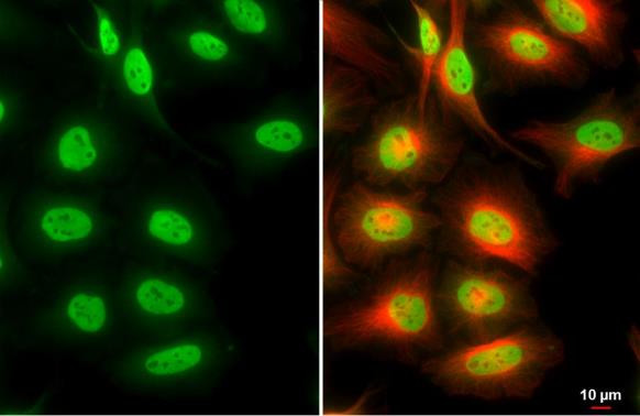 SMARCA2 Antibody in Immunocytochemistry (ICC/IF)