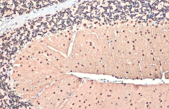 SMARCA2 Antibody in Immunohistochemistry (Paraffin) (IHC (P))