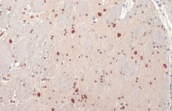 SMARCA2 Antibody in Immunohistochemistry (Paraffin) (IHC (P))