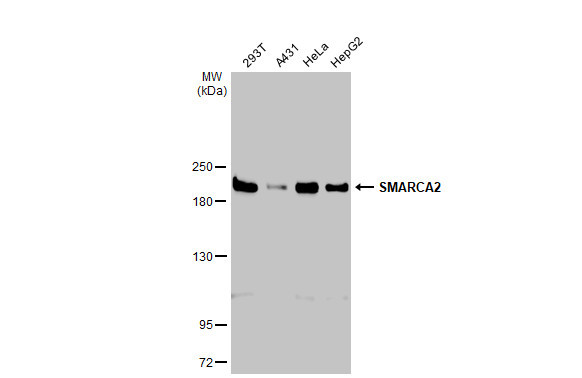 SMARCA2 Antibody in Western Blot (WB)