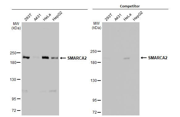 SMARCA2 Antibody in Western Blot (WB)