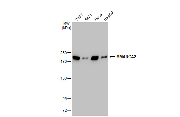SMARCA2 Antibody in Western Blot (WB)