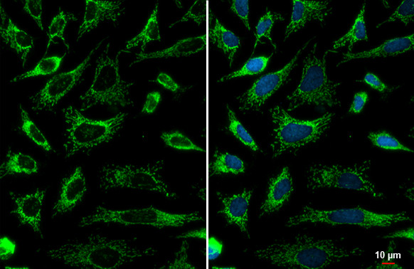 SDHA Antibody in Immunocytochemistry (ICC/IF)