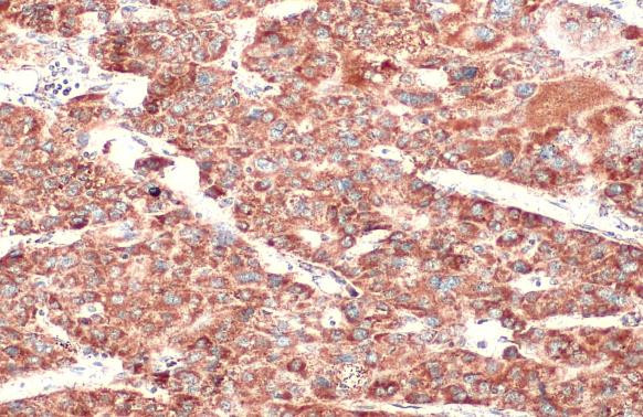 SDHA Antibody in Immunohistochemistry (Paraffin) (IHC (P))