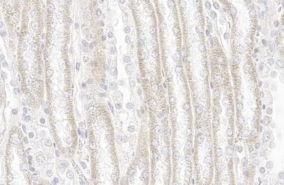 SDHA Antibody in Immunohistochemistry (Paraffin) (IHC (P))