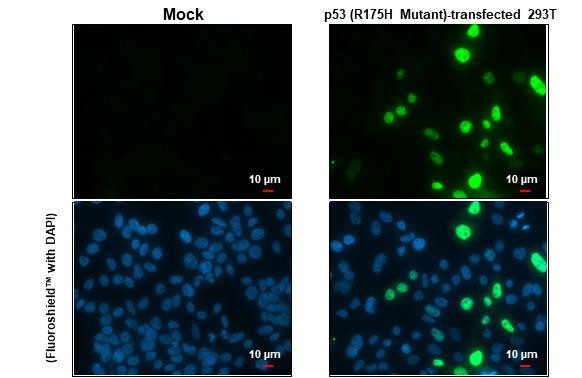 p53 (R175H Mutant) Antibody in Immunocytochemistry (ICC/IF)