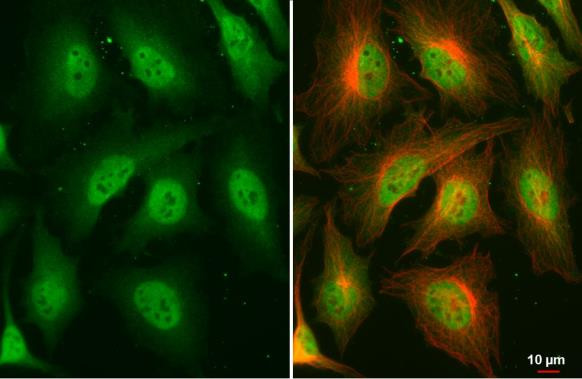 Thrombospondin 2 Antibody in Immunocytochemistry (ICC/IF)