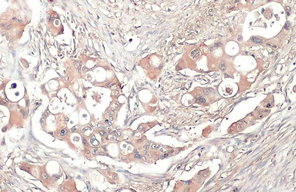 Thrombospondin 2 Antibody in Immunohistochemistry (Paraffin) (IHC (P))