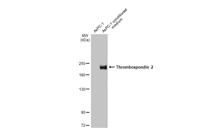 Thrombospondin 2 Antibody in Western Blot (WB)