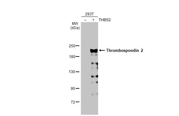 Thrombospondin 2 Antibody in Western Blot (WB)