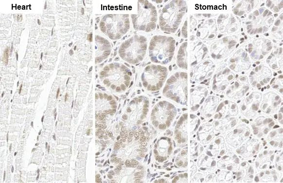 Glucocorticoid receptor (NR3C1) Antibody in Immunohistochemistry (Paraffin) (IHC (P))