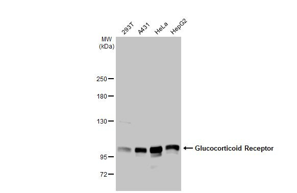 Glucocorticoid receptor (NR3C1) Antibody in Western Blot (WB)